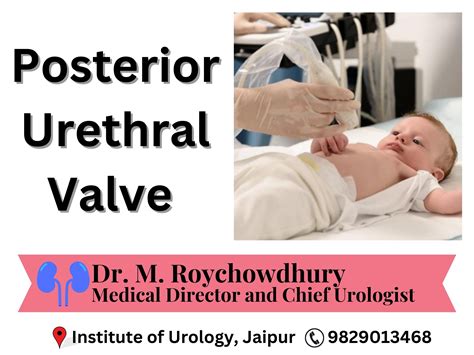 Posterior Urethral Valves: Causes, Symptoms, Diagnosis, and Treatment