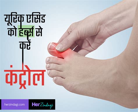 Herbs To Control High Levels Of Uric Acid | herbs to control high ...