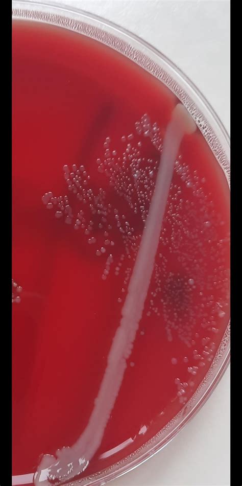 Moraxella catarrhalis Moraxella catarrhalis is a gram-negative ...