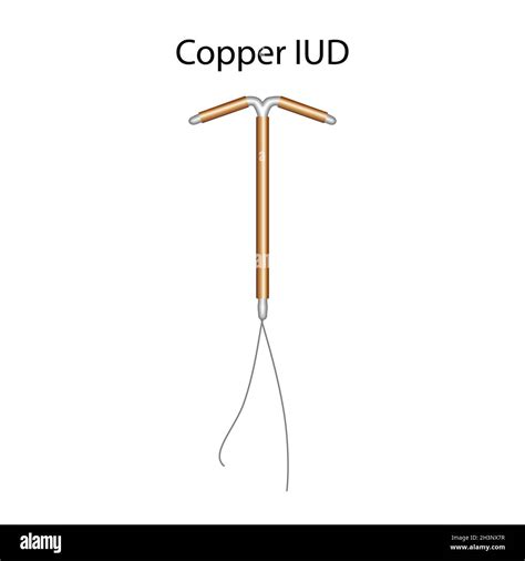 Copper intrauterine devices, illustration Stock Photo - Alamy