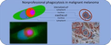 Non-Professional Phagocytosis Increases in Melanoma Cells and Tissues ...
