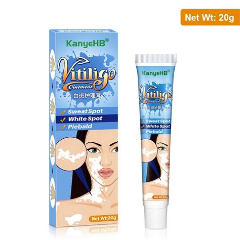 Buy KanyeHB Vitiligo Cream, Vitiligo Treatment, Vitiligo Skin Care ...