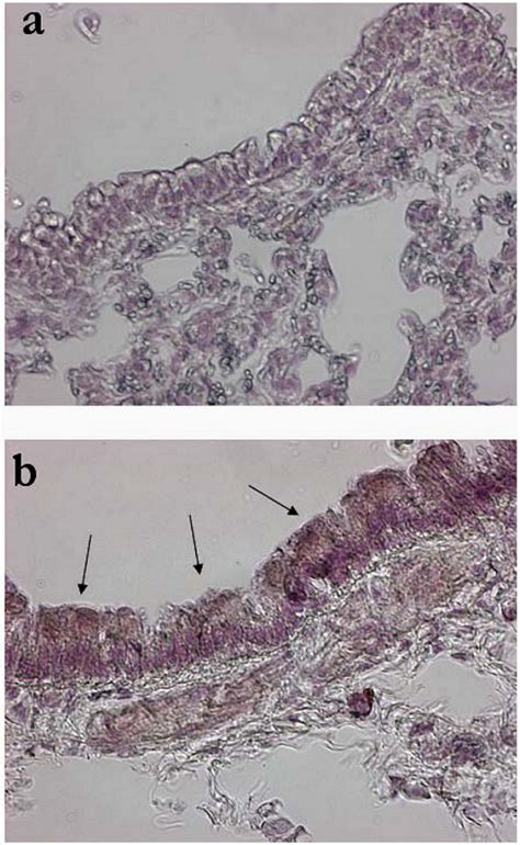 A VSV-G Pseudotyped Last Generation Lentiviral Vector Mediates High ...