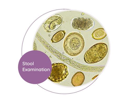 Image result for Stool Sample Test Results