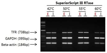 Life Technologies India: - FBS (foetal bovine serum, Fetal Bovine Serum ...