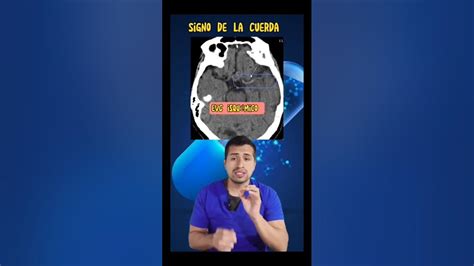 Identificando Signos de Desgaste en la Cuerda del Arco