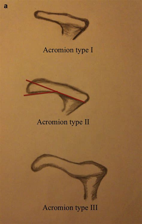 Image result for Acromion Function