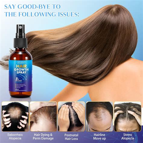 QRZBPZWE 5% Minoxidil Hair Growth Spray (2.02 OZ) for Men and India | Ubuy