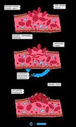 Conversion of Fibrinogen - Biology for GCSE/IGCSE - Year 11 PDF Download
