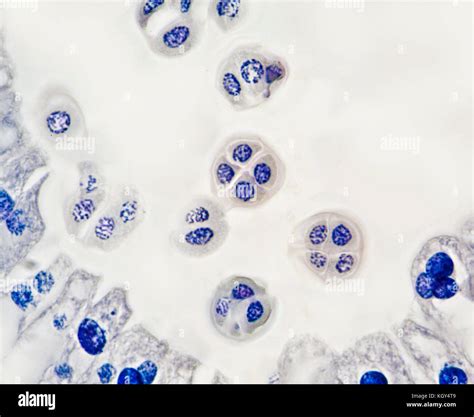 Meiosis Stages Under Microscope