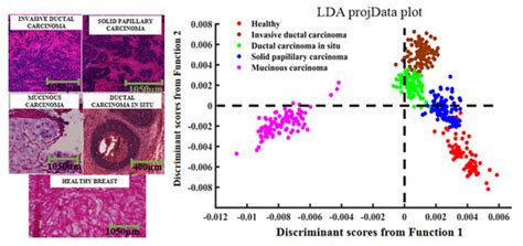Raman Microspectroscopic Investigation and Classification of Breast ...