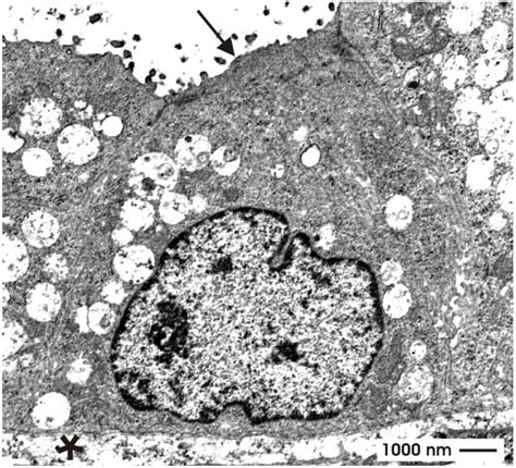 Towards a Guided Regeneration of Renal Tubules at a Polyester Interstitium