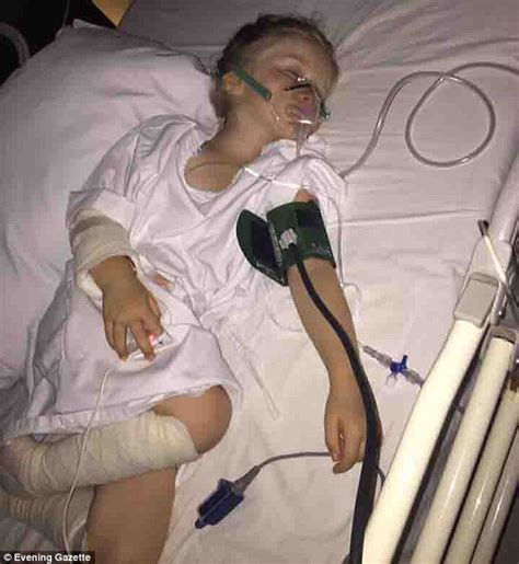 Image result for Appendix Exploded