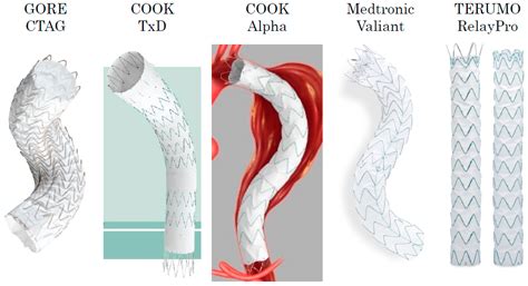 General Information and Applications of Najuta Fenestrated Stent Grafts ...