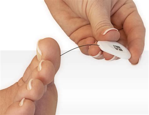 Diabetic Foot Check-ups: Assessing Risks and Preventing Complications