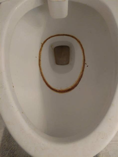 Poop Sticks To Toilet Bowl