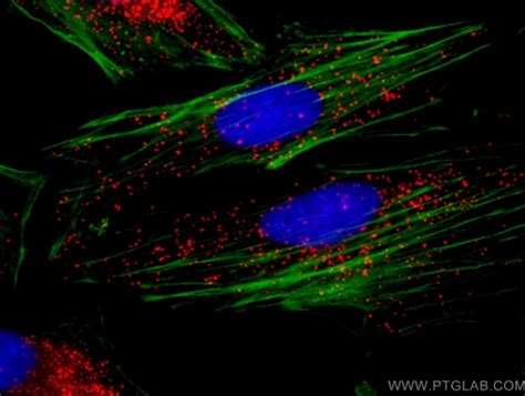 IHC & IF Analysis Workshop | Proteintech Group