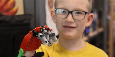 Teacher creates prosthetic hand for elementary student
