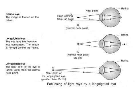 2022 Solutions For NCERT 10th Class Science Chapter Human Eye