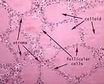 Image result for follicle 甲状腺滤泡
