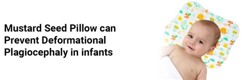Mustard Seed Pillow can Prevent Deformational Plagiocephaly in infants
