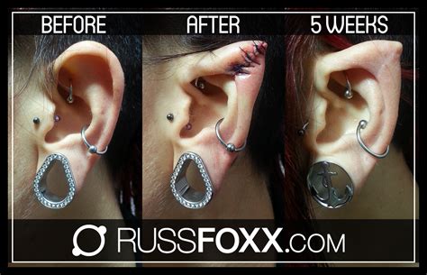 Body Piercing Plastic Surgery at Terrance Mitchell blog