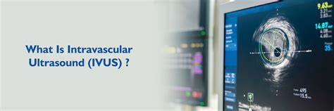 Intravascular Ultrasound (IVUS): Procedures and Facts