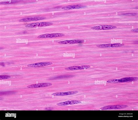 Smooth Muscle Under Microscope Labeled