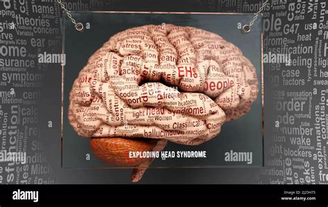 Image result for Exploding Brain