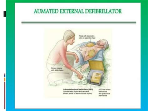 Image result for How to Use Automated External Defibrillator