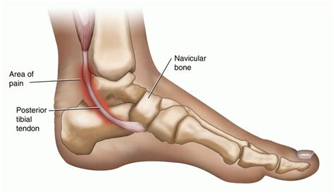 Foot & Ankle Pain: Foot Causes & Treatments | Elite Podiatry