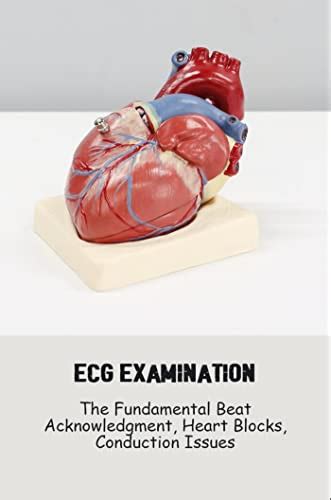 Ecg Examination: The Fundamental Beat Acknowledgment, Heart Blocks ...
