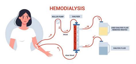 Kidney failure and its treatment options