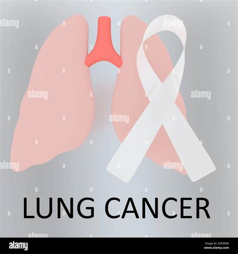 Lung Cancer Ribbon Clip Art