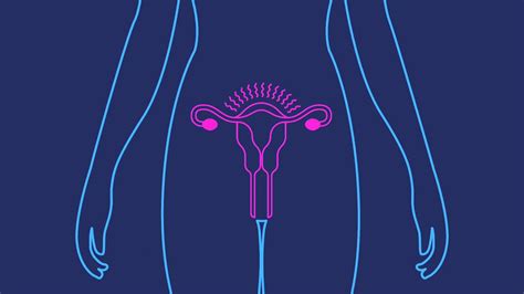 Birth Control Injection 的图像结果