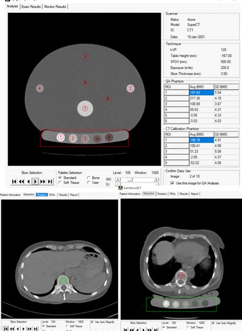 QCT 5 Pro Video Tutorials 的图像结果