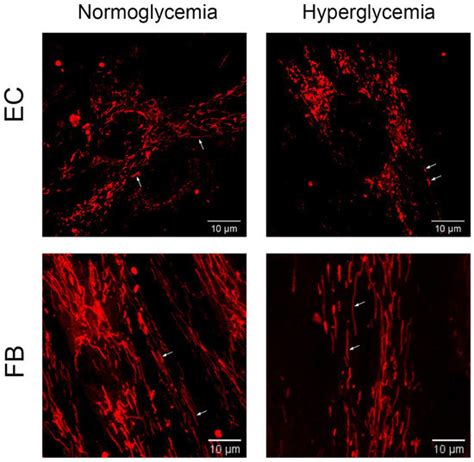 IJMS | Special Issue : Primary Mitochondrial Diseases and Secondary ...