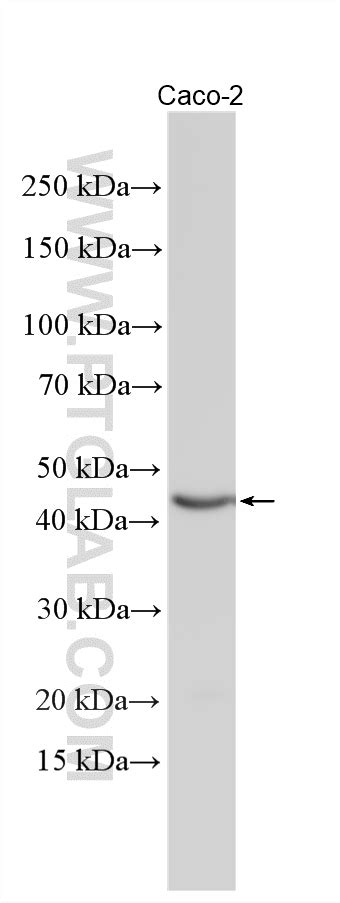 UBAP1L antibody (31189-1-AP) | Proteintech