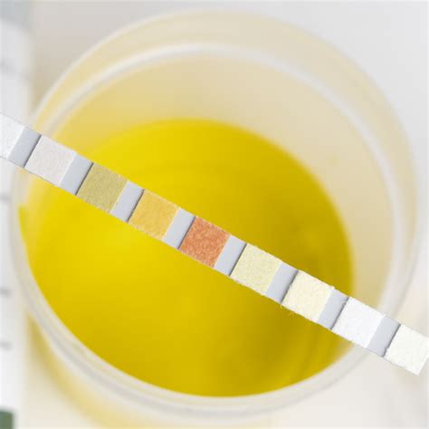 Maintaining Healthy Pregnancies With At-home Urine Test