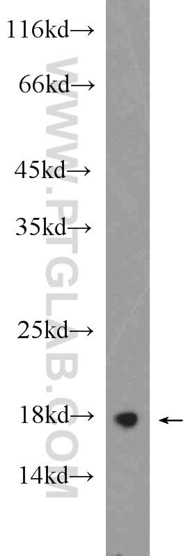 RHEB antibody (15924-1-AP) | Proteintech