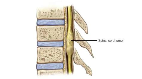 Best Orthopaedic in Hassan,Orthopaedic Surgery,Knee replacement in Hassan