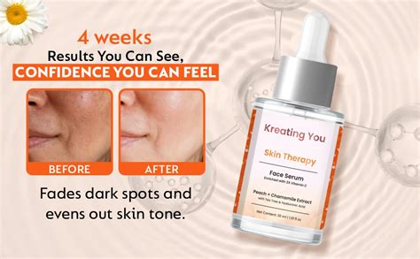 Vitamin C Serum for Oily Skin - 30% Vitamin C Face Serum with 5% ...