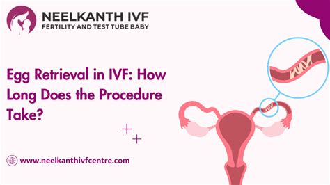 Egg Retrieval In IVF: How Long Does The Procedure Take?