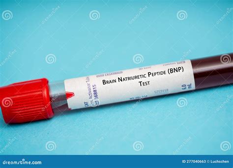 Brain Natriuretic Peptide (BNP) Test Stock Image - Image of peptide, brain: 277040663