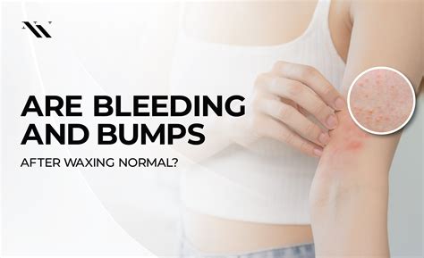 Is It Normal To Bleed When Waxing