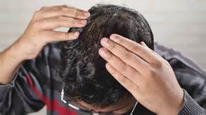 Will creatine make you lose hair?