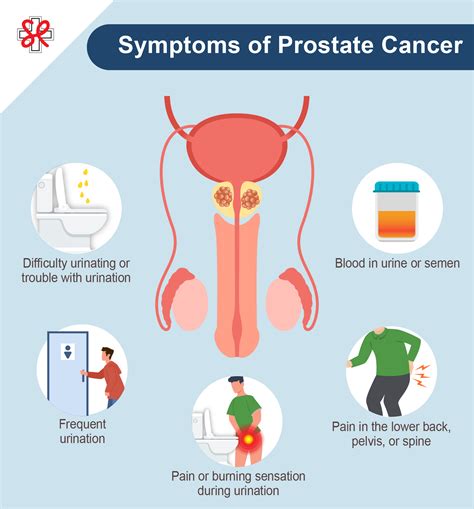 What is Prostate Cancer? Learn more about its Symptoms, Causes, and ...