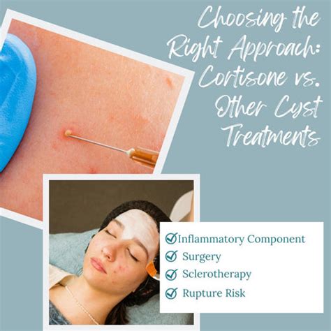 The Effectiveness of Cortisone Injections in Cyst Treatment | Clinikally