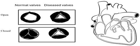 A Comparative Review of Quantum Neural Networks and Classical Machine ...