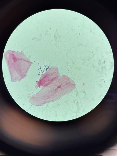 These are Gram positive cocci in pairs, right? Not yeast? : r/microbiology